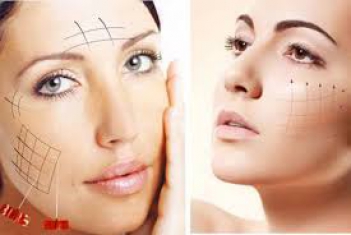 Độ tuổi nào thì có thể thực hiện căng da mặt không cần phẫu thuật? - Làm đẹp