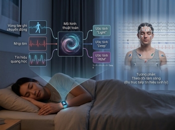 Vì sao độ chính xác sleep stage tracker có giới hạn?